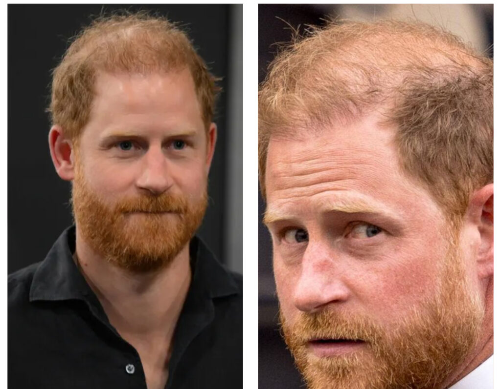 Prinz Harry: Ein Leben im Rampenlicht der Royals